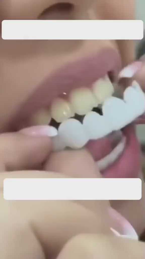 Carillas Dentales Cosmetica Snapon Smile
