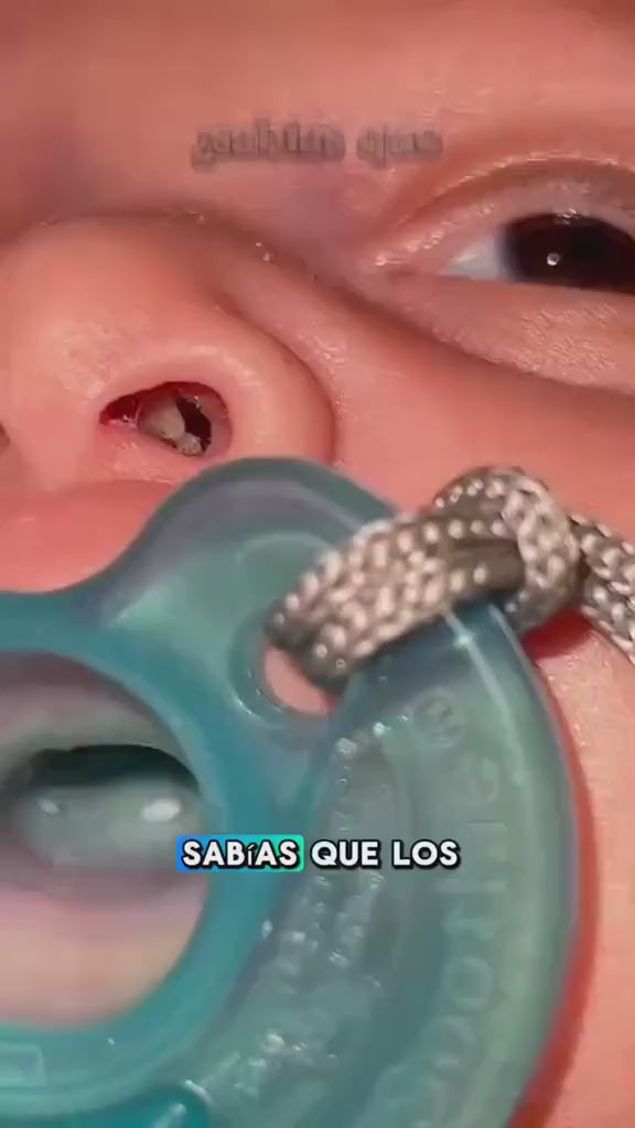 Aspirador eléctrico nariz oidos de bebe